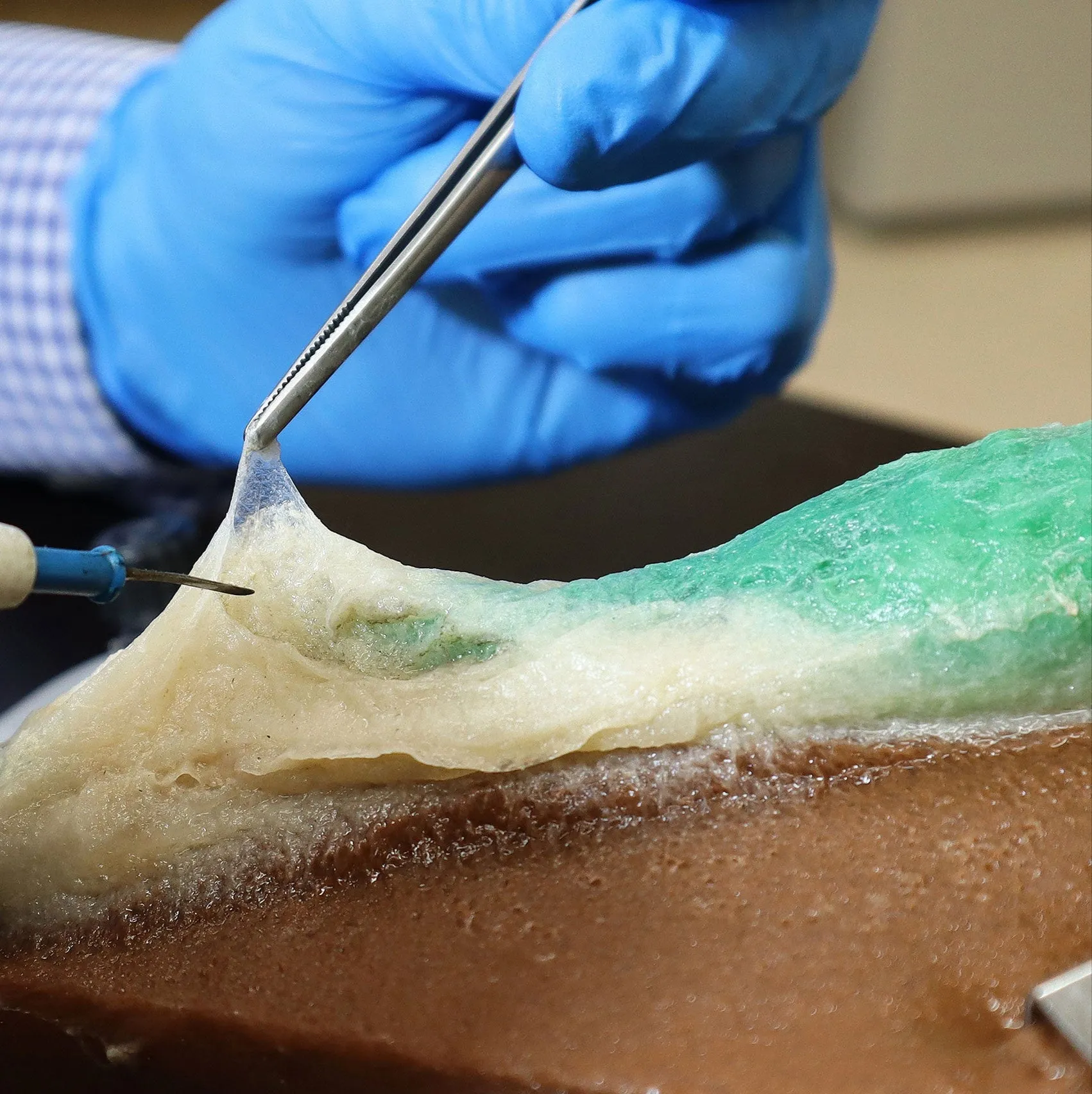 Cholecystectomy Model