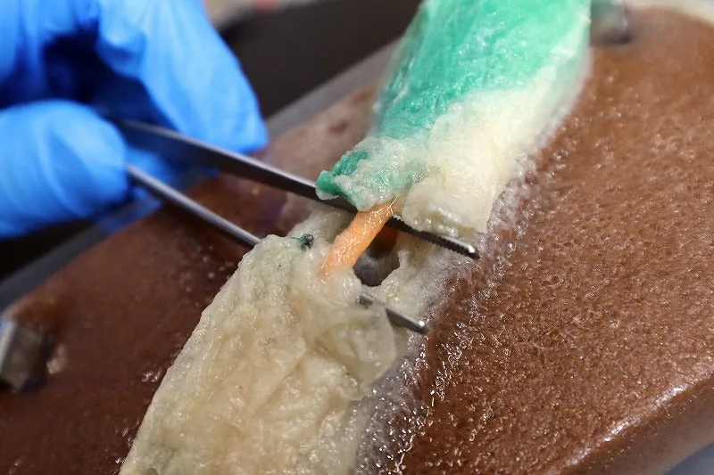 Cholecystectomy Model